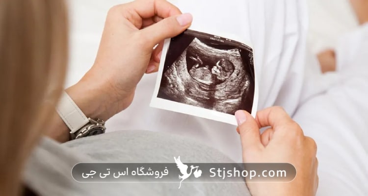  سونوگرافی در هفته دهم بارداری